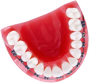 orthodontics-img