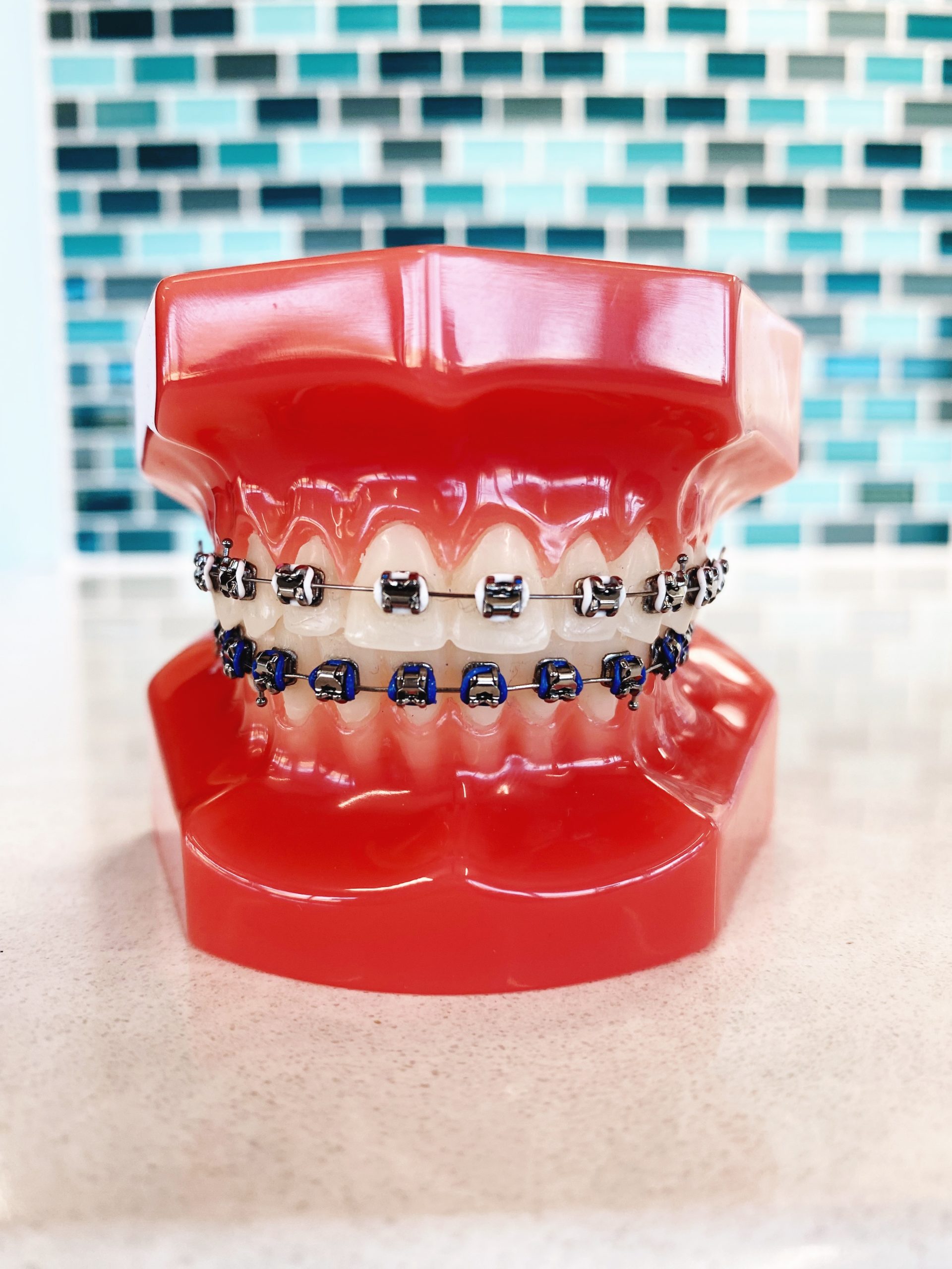 Blue and white color braces ruber band on 3d teeth