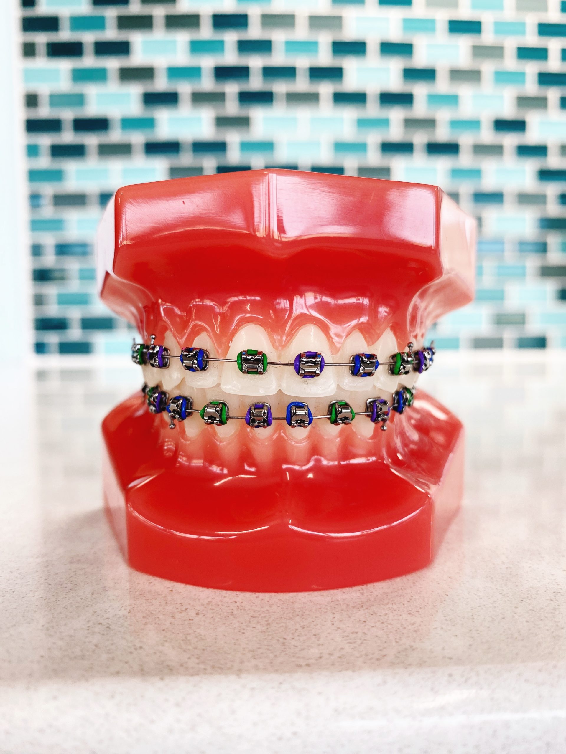 Braces Rubber Band Colors: Royal blue, emerald green and dark purple
