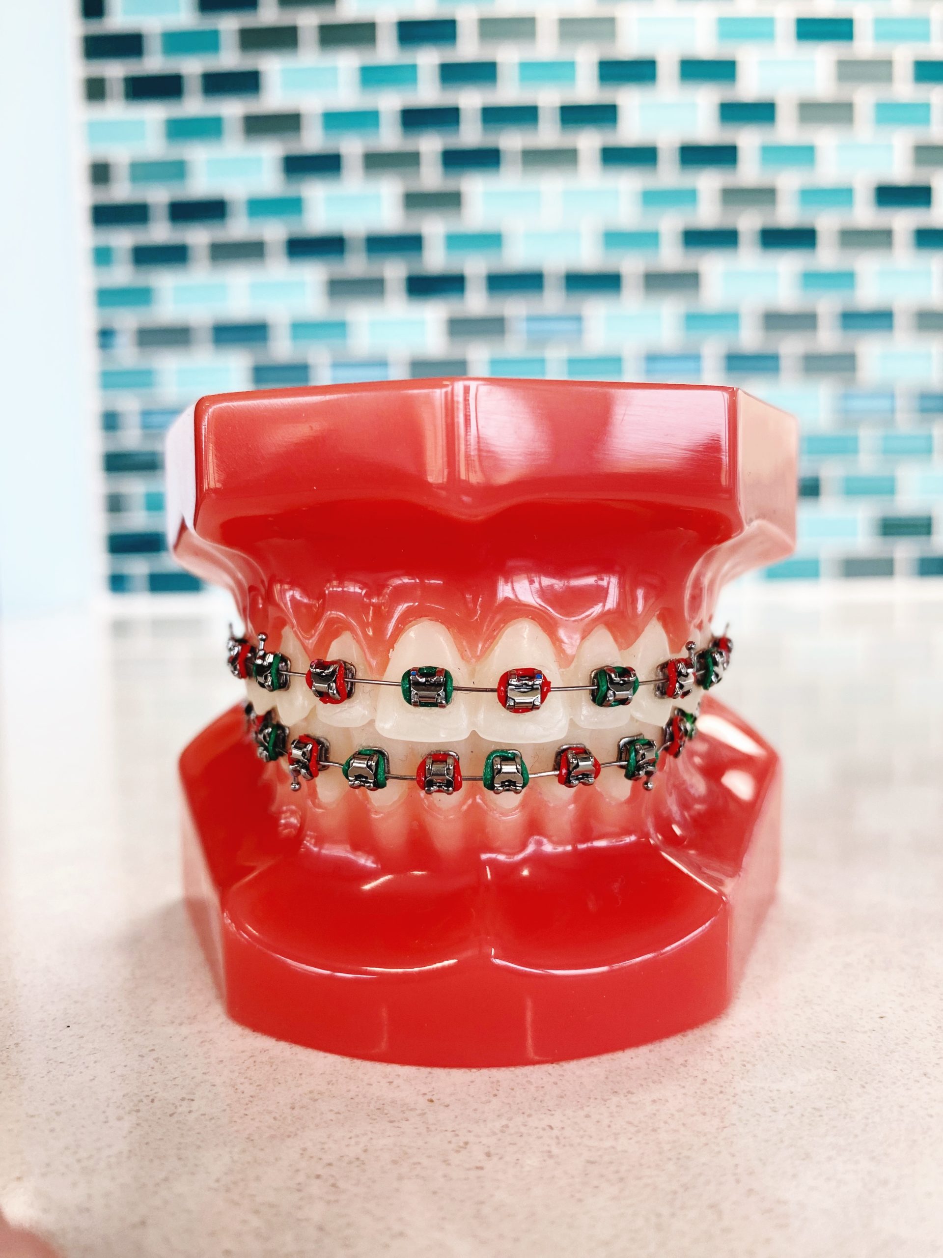 Braces Rubber Band Colors: Hunter green and cranberry