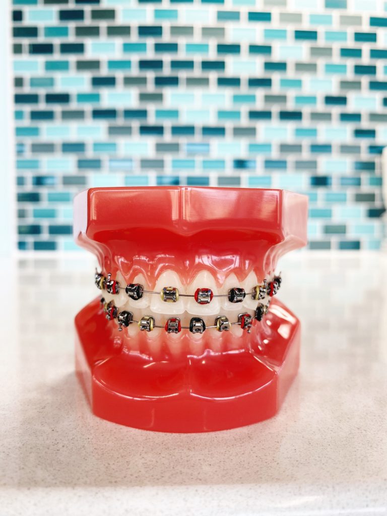 Dark green, red and gold braces on 3D teeth